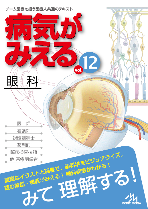最新巻「病気がみえるvol.12 眼科（第1版）」発売中。立ち読み公開中！