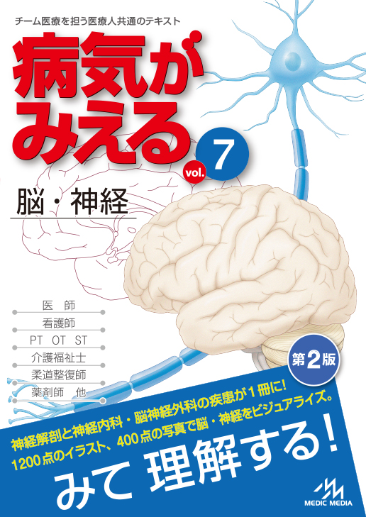 病気がみえる vol.7 脳・神経