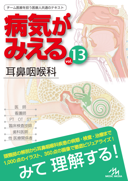 病気がみえる vol.13 耳鼻咽喉科