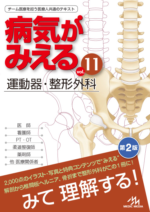 「病気がみえるvol.11 運動器・整形外科（第2版）」発売中！立ち読み公開中！